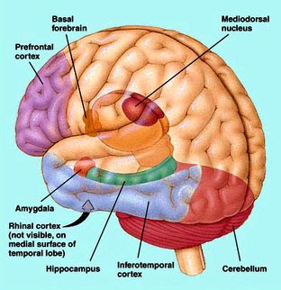 otak orang Indonesia dihargai 100 juta dollar Picture-of-brain2