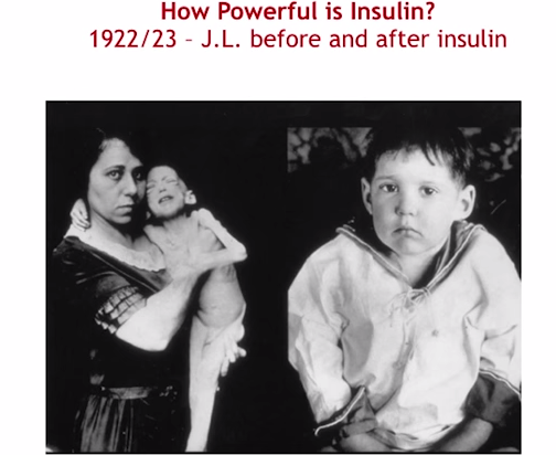 How powerful is insulin and weight gain. Screenshot%2B2015-04-28%2Bat%2B14.53.11