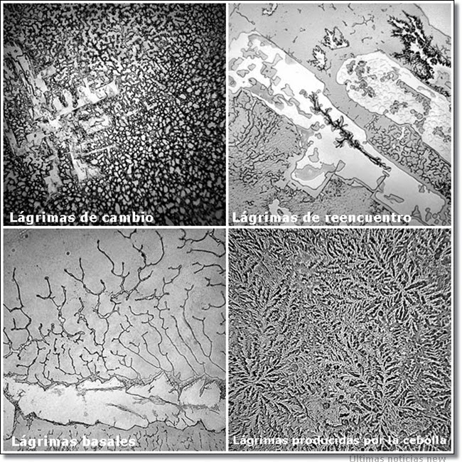 Las lagrimas vistas en un microscopio revelan hechos sorprendentes  La2