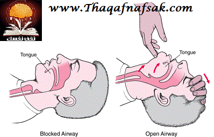 لانتعاش القلب والتنفس PHY_opening_an_airway_adult