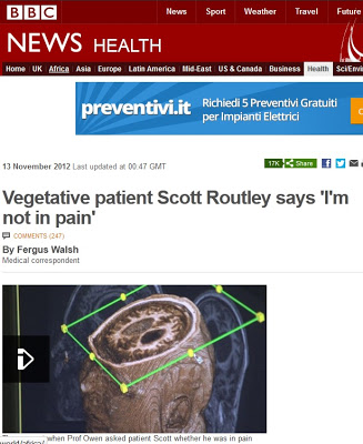 Paziente in stato vegetativo dice "io non soffro"  Vegetativo