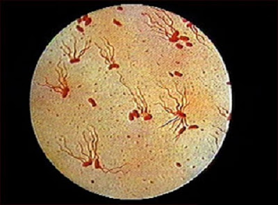 صور بكتيريا - Bacteria slides 1048