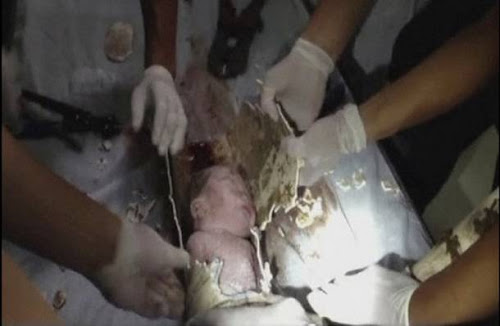 Σοκ!!! Πέταξαν το μωρό ζωντανό μέσα σε σωλήνα αποχέτευσης και σώθηκε - Βίντεο Baby--2-thumb-large