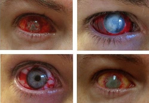 اخطار العدسات اللاصقة على العين. Awesome-contact-lenses-1