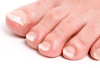 عندما تصرخ أقدامنـا في فصل الشتــاء  Getty_rf_photo_of_close_up_of__toes