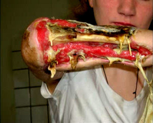 [OFF-Topic] KROKODIL:A droga zumbi russa que faz viciados Apodrecerem  Krokodil7