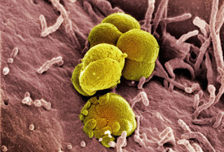 أسباب الالام أسفل البطن عند الاناث Princ_rm_photo_of_gonorrhea_bacteria