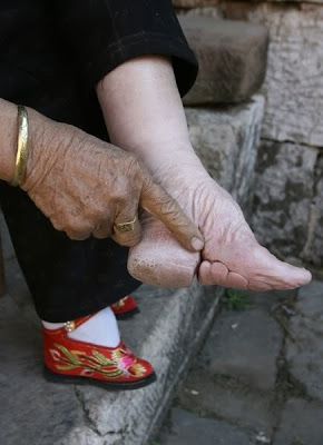 9 Budaya Aneh Yang Jarang kamu Temui Foot-binding