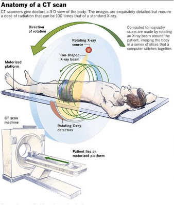 மருத்துவ கருவிகள் - தொடர் பதிவு Anatomy_of_a_CT_scan