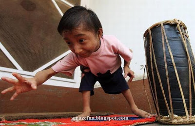 Smallest Person in the World 5