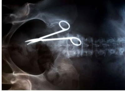 சில பயங்கர விபத்துகளின் எக்ஸ் - ரே புகைப்படங்கள்... - Page 5 Online-xray-pictures-surgical-instruments-left-beh1