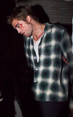 Rob bleeding Robert-pattinson-blood-6239-10