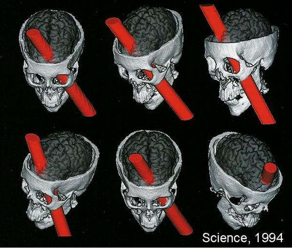 Pourvu que ça dure !!!  - Page 9 PhineasGage