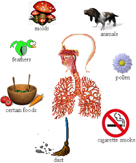 குழந்தைகளுக்கு வரும் ஆஸ்த்மா :  Asthma-triggers