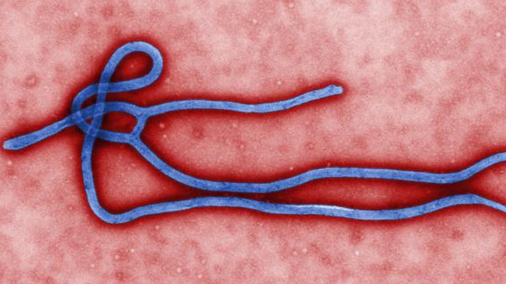 BREAKING: Hawaii "Ebola Concerns Patient Placed In Isolation" AP_ebola_virus_mar_140812_16x9_992