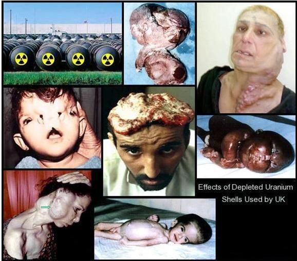  Les enfants de Falloudja, le massacre d'innocents... URANIUM-4