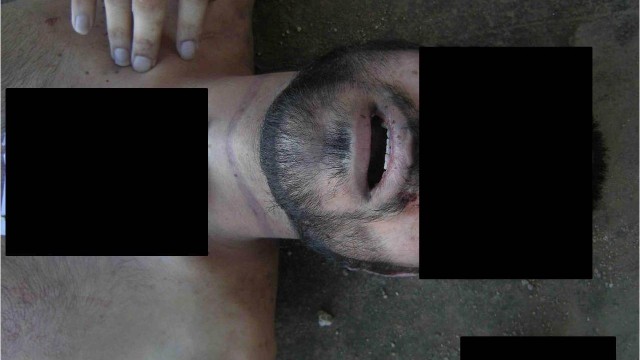 تقرير يضم صور حصرية لسي ان ان والغارديان لضحايا تعذيب في سجون نظام الأسد +18 140120113559-hfr-amanpour-report-3-horizontal-gallery