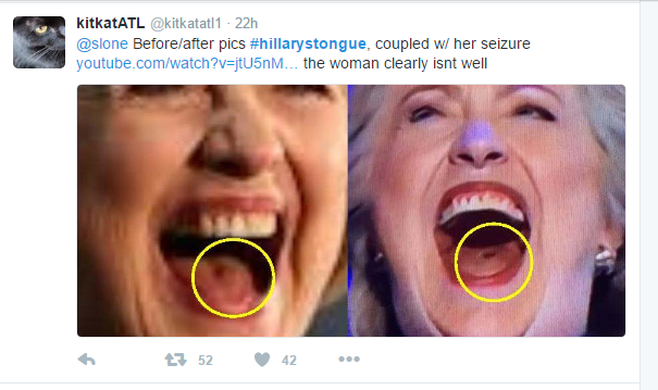 Has Bill Clinton Been Lobotomized? Is Hillary Clinton 'Satan Incarnate On The Earth'? Hillary_tongue