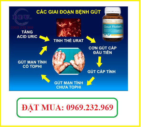 Sức khỏe, đời sống: Thuốc điều trị gout-gout relief Thuoc-dieu-tri-gout-gout-relief