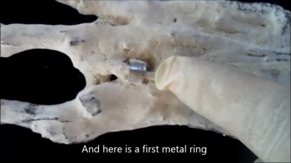 Strange Discovery: Three-Fingered Alien-Looking Hand Found in Peru Metal-570x320