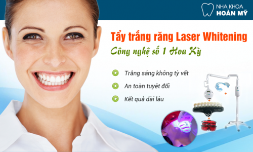 Chuyên gia tư vấn: Những cách tẩy ố vàng răng hiệu quả nhất Tay-trang-rang-bang-laser-giu-duoc-bao-lau-e1425607701531
