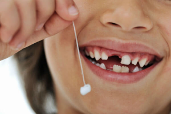 Tập làm bác sĩ nhổ răng sữa cho trẻ không hề khó với phương pháp này Nho-rang-sua-bi-sau2