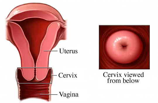 Uitstrijkje Cervix2