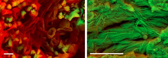 Carbon-14-dated dinosaur bones, non permineralized fossils, and soft tissue like proteins are evidence of young fossils - Page 2 Soft