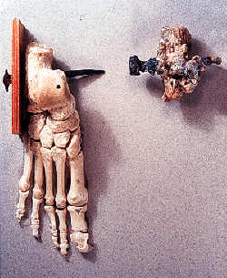Deux clous romains dans la tombe d'un prêtre Juif Crucifie-givea