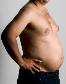 Post à flood; - Page 26 Adipomastie-et-tour-de-taille-augmente-chez-homme-en-surpoids-tags-obese-gynecomastie-torse-nu-iStockphoto