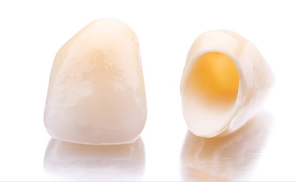 Răng toàn sứ có bền không? So sánh các loại răng toàn sứ Boc-su-4-rang-cua-2