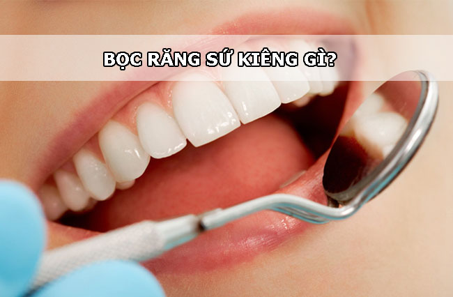 Bọc răng sứ kiêng gì? [Giải đáp từ chuyên gia nha khoa] Boc-rang-su-kieng-gi-1