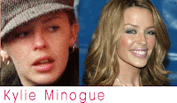 Celebrities without makeup... KylieMinogue