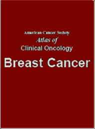 Breast Cancer Atlas of Clinical Oncology Pic