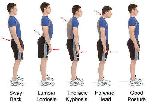 Exercise For Good Posture--ممارسة لموقف جيد Postures