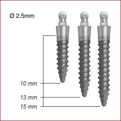 Phương pháp cấy ghép Implant chỉ trong 1 ngày Co-bao-nhieu-loai-tru-implant-01-400x400