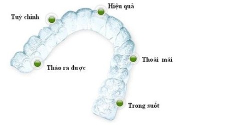 Niềng răng tháo lắp có mang lại hiệu quả cao không ? Nieng-rang-thao-lap-co-mang-lai-hieu-qua-cao-khong-1