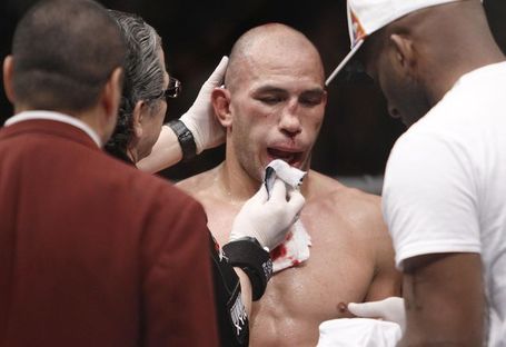 Brandon Vera cut by UFC Brandon-vera-broken-nose-photos_medium