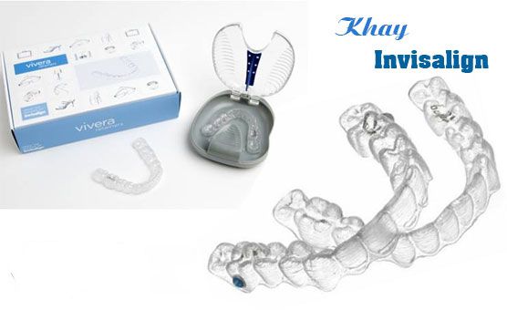 Niềng răng không mắc cài tại Đăng Lưu Nieng-rang-invisalign-co-tot-khong-1