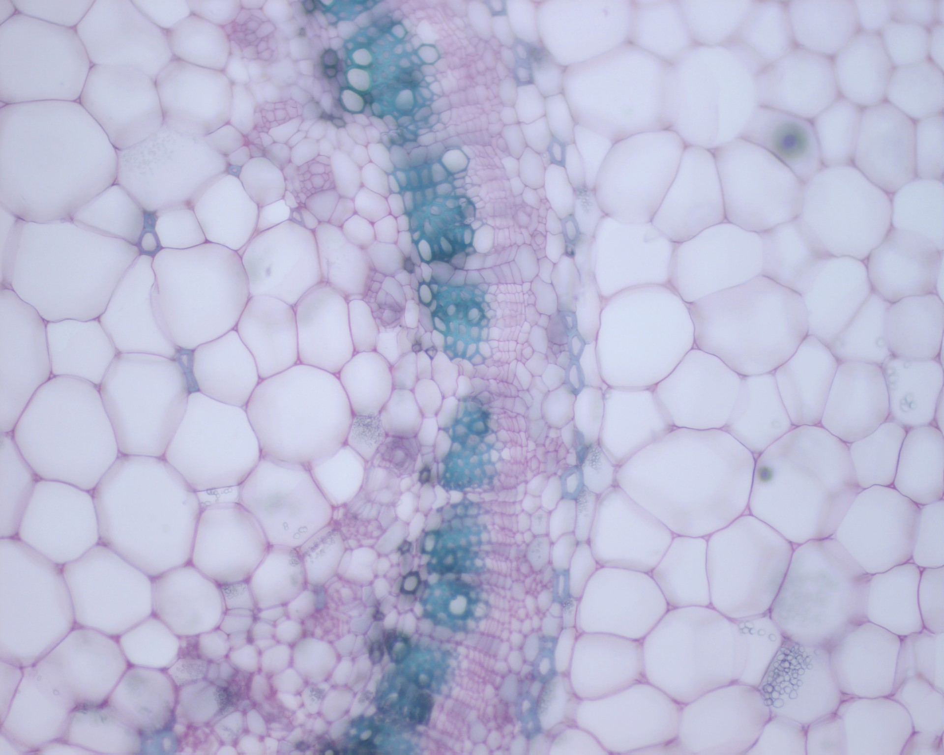 Histologie Vegetale - CT Solanum CT%20Solanum2x4