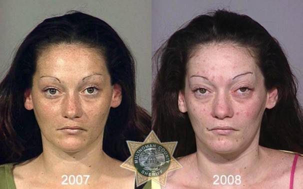 Le saviez-vous?10 photos de personnes avant et après qu’elles soient toxicomanes ! 17ffc621940162dd114601fcc8f01b4f