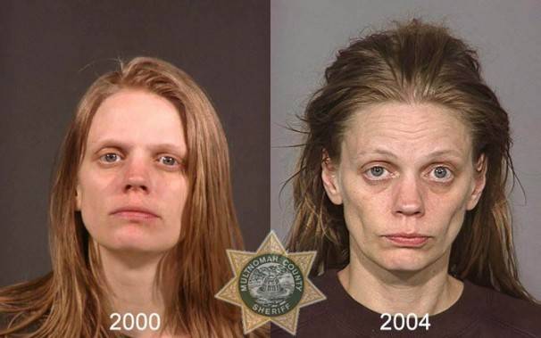 Le saviez-vous?10 photos de personnes avant et après qu’elles soient toxicomanes ! 2d8c710c50cdf7f331c43ff31b00a11e