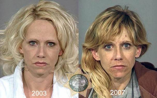 Le saviez-vous?10 photos de personnes avant et après qu’elles soient toxicomanes ! 36f2b0f74a9ba622c01fbd02bf8a4550
