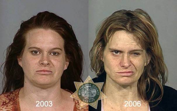 Le saviez-vous?10 photos de personnes avant et après qu’elles soient toxicomanes ! 967e1529d17d720f7f4eab71a75f301b