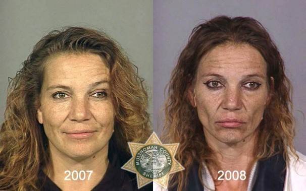 Le saviez-vous?10 photos de personnes avant et après qu’elles soient toxicomanes ! A6348fb8be22c9b05e961a798dba2c2c