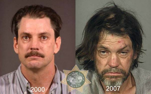 Le saviez-vous?10 photos de personnes avant et après qu’elles soient toxicomanes ! Dc046826d48d3c1f310e8968a590ec8a