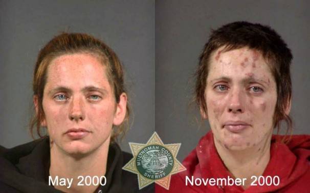 Le saviez-vous?10 photos de personnes avant et après qu’elles soient toxicomanes ! Fb652dfb31d5bb8f5ecec32b8fc1350a