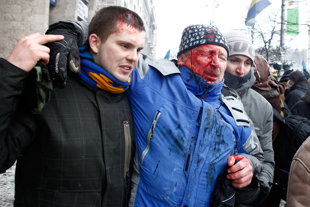 manifestation contre le gouvernement Bleeding-man