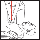 CPR (Cardiopulmonary Resuscitation) Pumpani