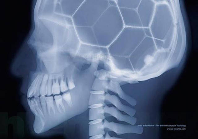 Acciones y cosas en rayos X. Xrays_show_the_human_body_like_youve_never_seen_it_before_640_12